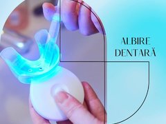 Dental Implant Clinic Floreasca