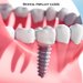 Dental Implant Clinic Floreasca
